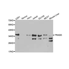 Anti TRADD Antibody gallery image 1