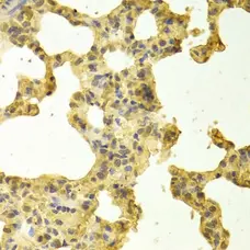 Anti TRADD Antibody gallery image 2