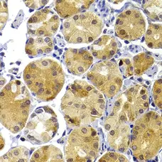 Anti TRAF3 Antibody gallery image 3