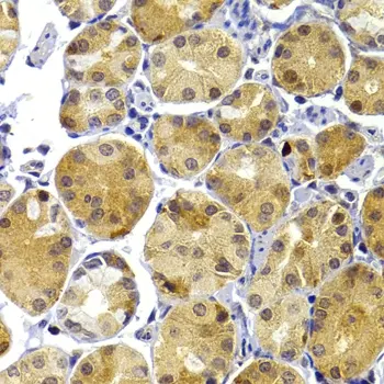 Anti TRAF3 Antibody gallery image 3