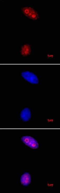 Anti Tri-Methyl-Histone H3 (Lys27) Antibody gallery image 1