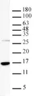 Anti Tri-Methyl-Histone H3 (Lys36) Antibody thumbnail image 1