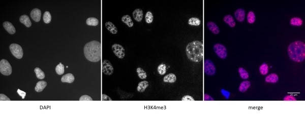 Anti Tri-Methyl-Histone H3 (Lys4) Antibody gallery image 2