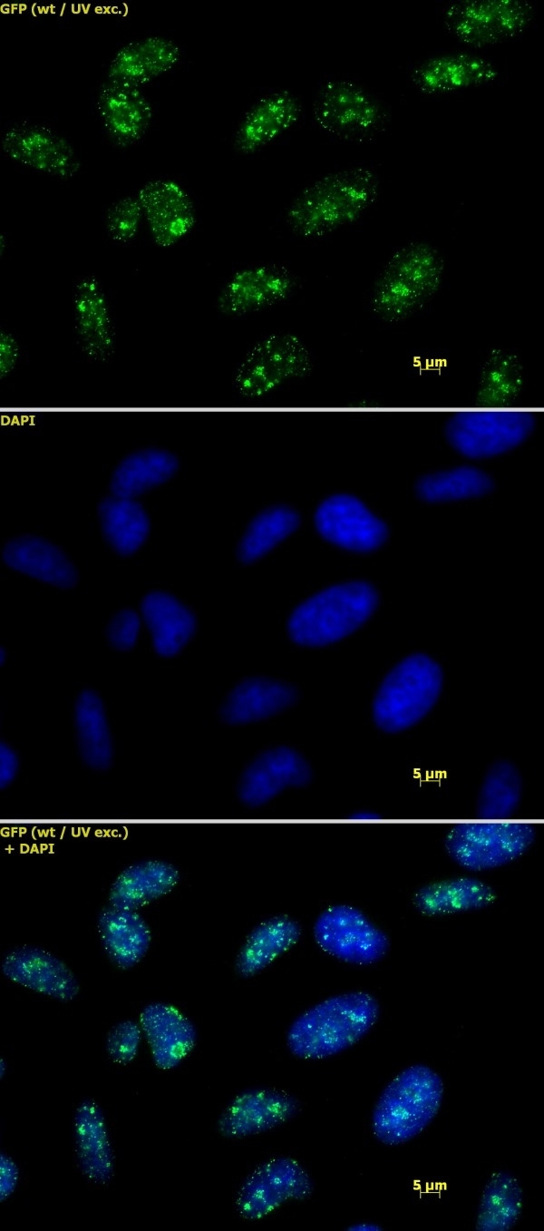 Anti Tri-Methyl-Histone H3 (Lys9) Antibody gallery image 1