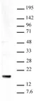 Anti Tri-Methyl-Histone H3 (Lys9) Antibody thumbnail image 2
