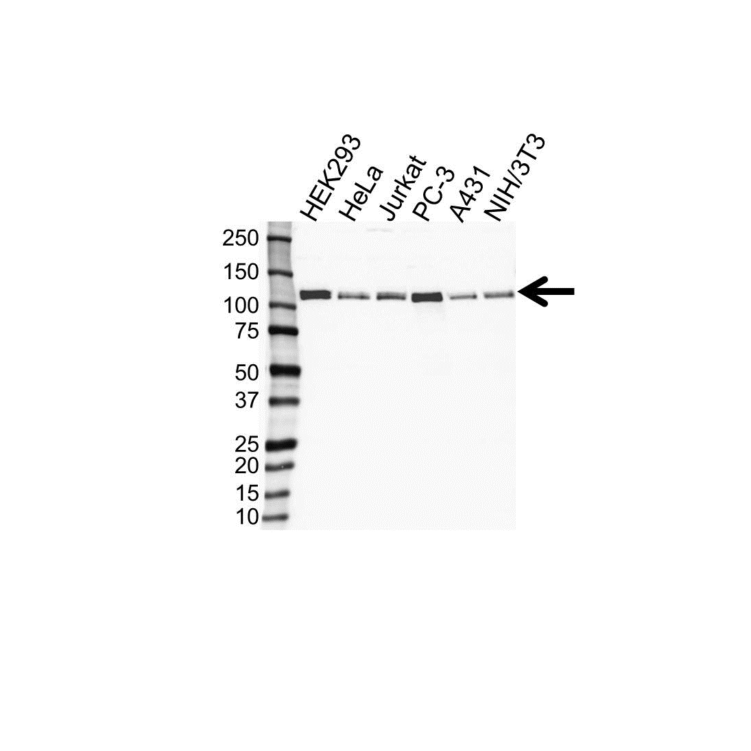 Anti TRIM28 Antibody (PrecisionAb Polyclonal Antibody) gallery image 1