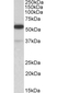 Anti Human TRIM5 Alpha (N-Terminal) Antibody thumbnail image 1