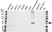 Anti Troponin T (Cardiac) Antibody (PrecisionAb Polyclonal Antibody) thumbnail image 1