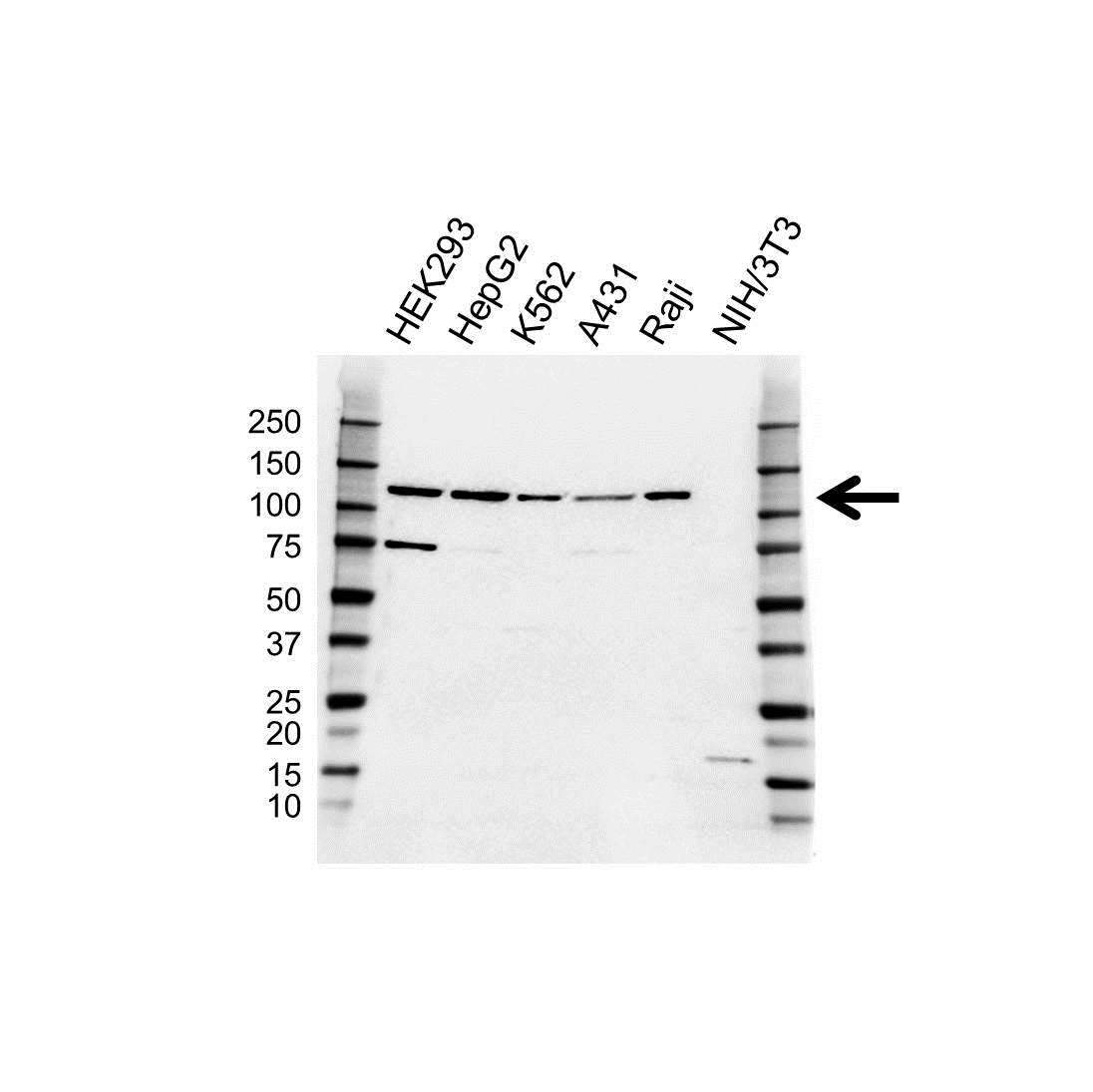 Anti TRPC6 Antibody (PrecisionAb Polyclonal Antibody) gallery image 1