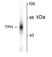 Anti Tryptophan Hydroxylase Antibody thumbnail image 1
