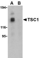 Anti TSC1 Antibody gallery image 1