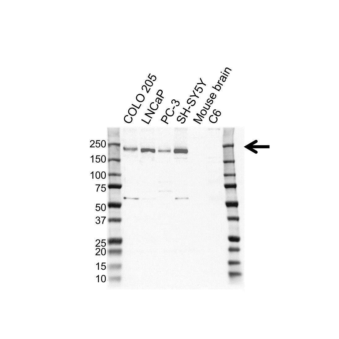 Anti TSC2 Antibody (PrecisionAb Polyclonal Antibody) gallery image 1