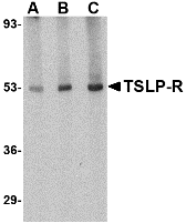 Anti Human TSLP Receptor Antibody gallery image 1