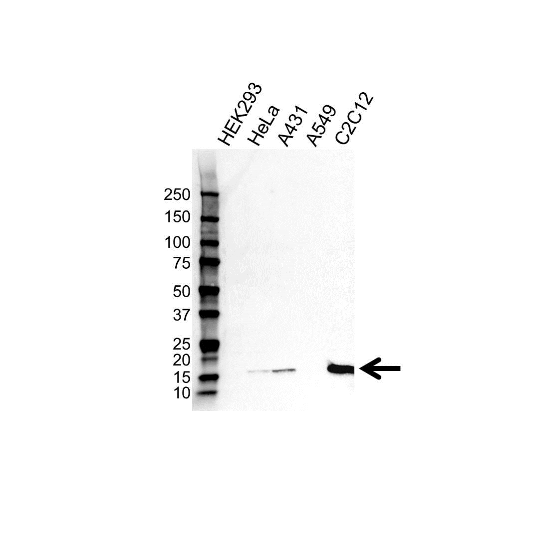 Anti Tspo Antibody (PrecisionAb Polyclonal Antibody) gallery image 1