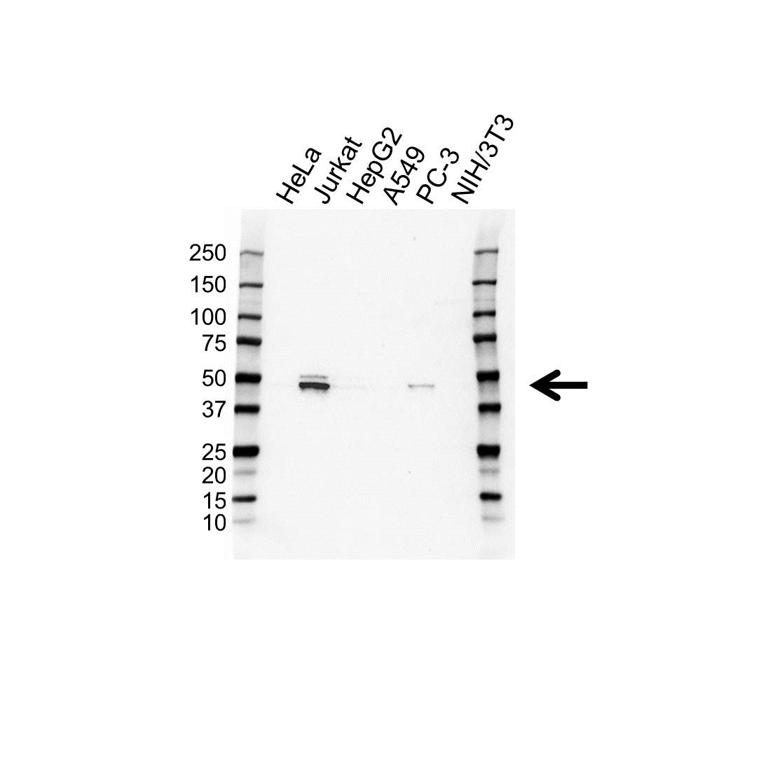 Anti Ttp Antibody (PrecisionAb Polyclonal Antibody) gallery image 1