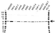 Anti Tubulin Alpha 4A Chain Antibody (PrecisionAb Polyclonal Antibody) gallery image 1