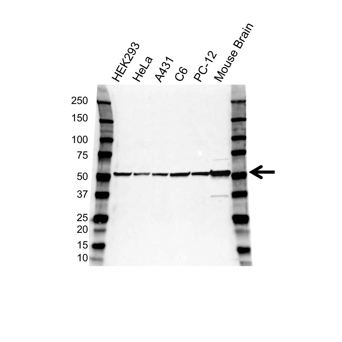 Anti Tubulin Beta 4B Antibody (PrecisionAb Polyclonal Antibody) gallery image 1