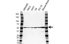 Anti Tubulin Beta 4B Antibody (PrecisionAb Polyclonal Antibody) gallery image 1