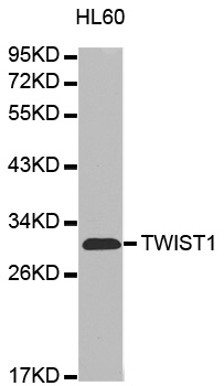 Anti TWIST1 Antibody gallery image 1
