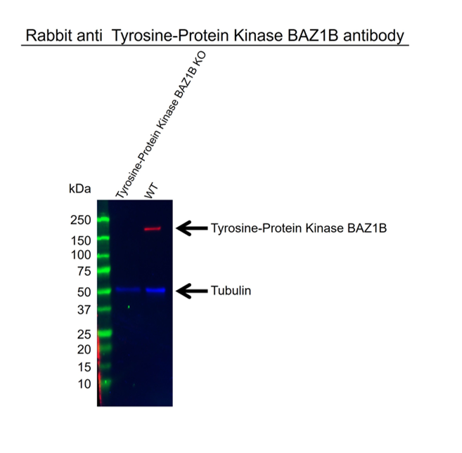 Anti Tyrosine-Protein Kinase BAZ1B Antibody (PrecisionAb Polyclonal Antibody) gallery image 2