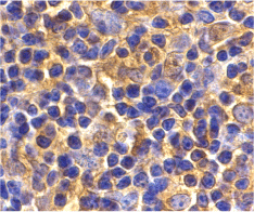 Anti UBC13 Antibody (PrecisionAb Polyclonal Antibody) gallery image 2
