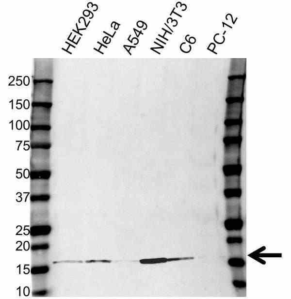 Anti UBE2D3 Antibody (PrecisionAb Polyclonal Antibody) gallery image 1