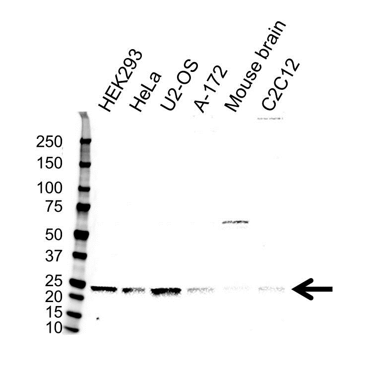Anti UBE2K Antibody (PrecisionAb Polyclonal Antibody) thumbnail image 1