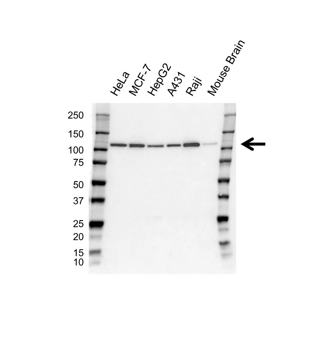 Anti USP16 Antibody (PrecisionAb Polyclonal Antibody) gallery image 1