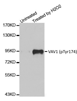 Anti VAV1 (pTyr174) Antibody gallery image 1