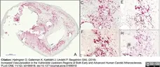 Anti Human VEGF Antibody gallery image 1