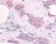 Anti Human VEGF Receptor 2 Antibody thumbnail image 1