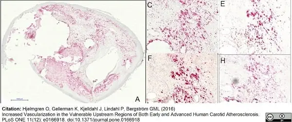 Anti Human VEGF Receptor 2 Antibody gallery image 2