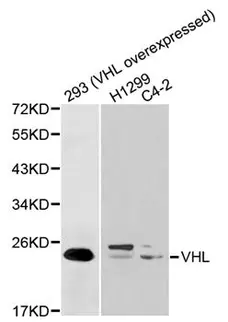 Anti VHL Antibody gallery image 1