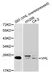 Anti VHL Antibody thumbnail image 1