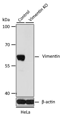 Western blot analysis of HeLa cell lysate untreated or treated with CIP using Rabbit Anti-EEF2K (pSer366) Antibody at a 1/1,000 dilution. 