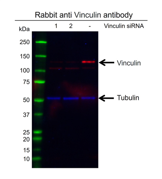 Anti Vinculin Antibody (PrecisionAb Polyclonal Antibody) gallery image 2