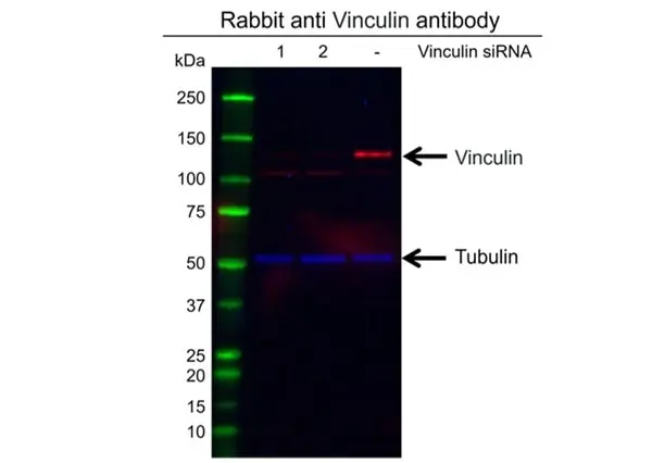 Anti Vinculin Antibody (PrecisionAb Polyclonal Antibody) gallery image 2