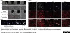 Anti Human von Willebrand Factor Antibody gallery image 1