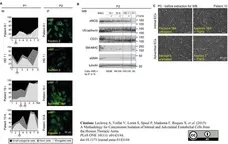 Anti Human von Willebrand Factor Antibody gallery image 2