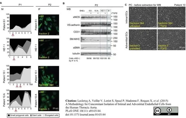 Anti Human von Willebrand Factor Antibody gallery image 2