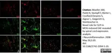 Anti Human von Willebrand Factor Antibody gallery image 3