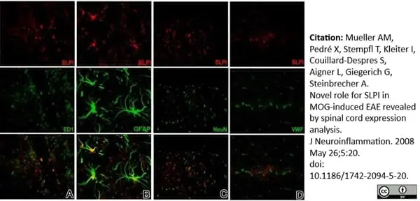 Anti Human von Willebrand Factor Antibody gallery image 3
