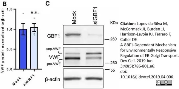Anti Human von Willebrand Factor Antibody gallery image 6