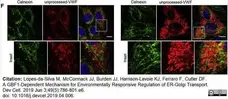 Anti Human von Willebrand Factor Antibody gallery image 7