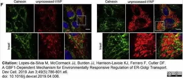 Anti Human von Willebrand Factor Antibody gallery image 7