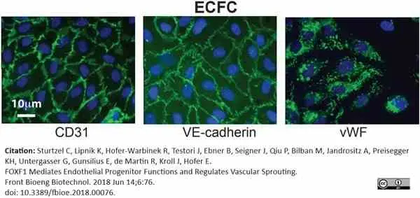 Anti Human von Willebrand Factor Antibody gallery image 8
