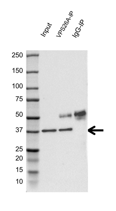 Anti VPS26A Antibody (PrecisionAb Polyclonal Antibody) gallery image 2