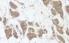 Anti Human WNT-3a Antibody gallery image 2