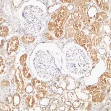 Anti XIAP (C-Terminal) Antibody gallery image 1