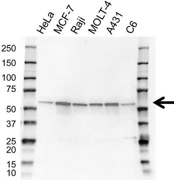 Anti XIAP Antibody (PrecisionAb Polyclonal Antibody) gallery image 1